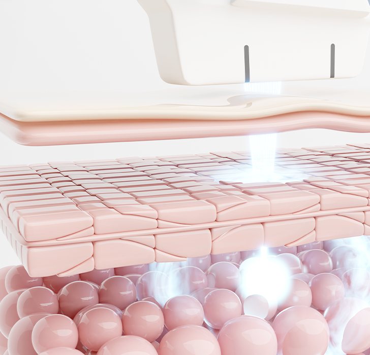 피부층 3D 그림과 리프팅 기기 끝